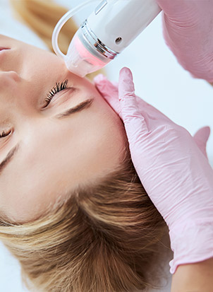 Microneedling-service