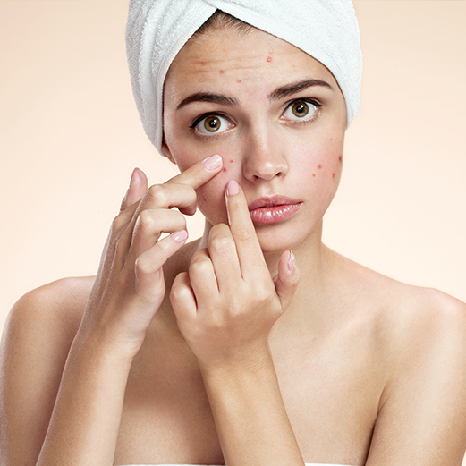 acne treatment dubai