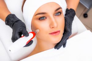 dermapen apparatus hands beautician new skin rejuvenation procedure fractional mesotherapy procedure cosmetic device